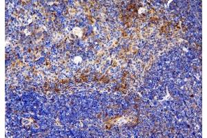 IHC analysis of CCR6 using anti-CCR6 antibody (ABIN7603110). (CCR6 Antikörper  (N-Term))