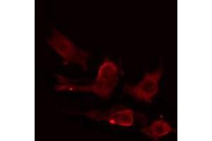 ABIN6275224 staining HuvEc cells by IF/ICC. (MIA2 Antikörper  (C-Term))
