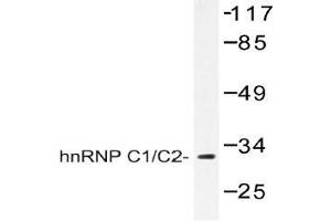 Western blot (WB) analysis of hnRNP C1/C2 antibody in extracts from HepG2 cells. (HNRNPC Antikörper)
