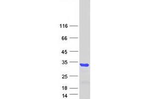 Validation with Western Blot (BCL11A Protein (Transcript Variant 3) (Myc-DYKDDDDK Tag))