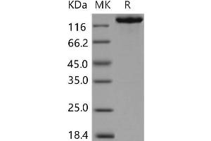 Western Blotting (WB) image for DEAD/H (Asp-Glu-Ala-Asp/His) Box Polypeptide 11 (DDX11) protein (Fc Tag) (ABIN7320028) (DDX11 Protein (Fc Tag))