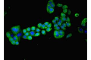 Immunofluorescent analysis of PC-3 cells using ABIN7159273 at dilution of 1:100 and Alexa Fluor 488-congugated AffiniPure Goat Anti-Rabbit IgG(H+L) (MAGEA8 Antikörper  (AA 1-270))