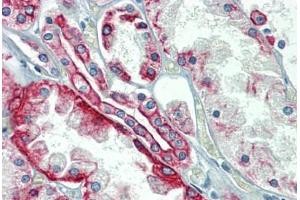 Kidney, Human: Formalin-Fixed, Paraffin-Embedded (FFPE) (Cytokeratin 18 Antikörper)