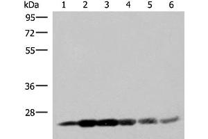 Western blot analysis of 293T cell lysates using GSTK1 Polyclonal Antibody at dilution of 1:250 (GSTK1 Antikörper)