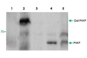 Western blot using PNKP polyclonal antibody  shows detection of a 57 kDa band corresponding to : Lane 1, human PNKP in a Y190 yeast cell lysate. (PNKP Antikörper  (Internal Region))