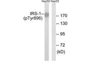Western blot analysis of extracts from HepG2 cells treated with Na3VO4 0. (IRS1 Antikörper  (pTyr896))