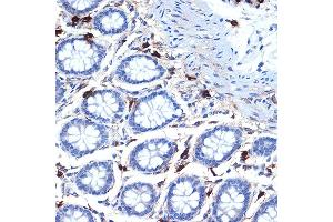 Immunohistochemistry of paraffin-embedded human colon using Mast Cell Tryptase (TPSB2) (TPSB2) Rabbit mAb (ABIN7271017) at dilution of 1:100 (40x lens). (TPSB2 Antikörper)