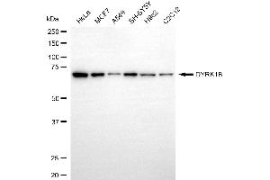 anti-Dual-Specificity tyrosine-(Y)-phosphorylation Regulated Kinase 1B (DYRK1B) antibody