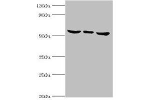 Western blot All lanes: MAPK15 antibody at 6 μg/mL Lane 1: Hela whole cell lysate Lane 2: MCF-7 whole cell lysate Lane 3: HepG2 whole cell lysate Secondary Goat polyclonal to rabbit IgG at 1/10000 dilution Predicted band size: 60, 29, 32 kDa Observed band size: 60 kDa (MAPK15 Antikörper  (AA 1-95))