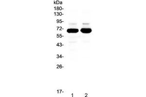 Western blot testing of 1) rat brain and 2) mouse brain lysate with SF1 antibody at 0. (Splicing Factor 1 Antikörper)