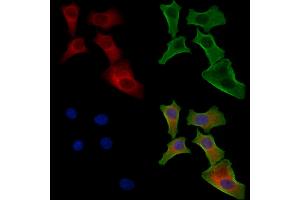 ABIN6257016 and ABIN6274443 staining Hela cells by IF/ICC.