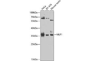 Western blot analysis of extracts of various cell lines, using MLF1 antibody (ABIN6128238, ABIN6143875, ABIN6143877 and ABIN6224035) at 1:1000 dilution. (MLF1 Antikörper  (AA 1-268))