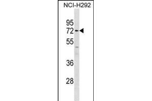 P14 Antibody (C-term) (ABIN1881546 and ABIN2838848) western blot analysis in NCI- cell line lysates (35 μg/lane). (MMP14 Antikörper  (C-Term))