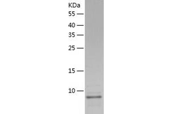 Betacellulin Protein (BTC) (AA 32-111) (His tag)