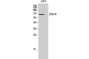 Western Blotting (WB) image for anti-Interleukin-1 Receptor-Associated Kinase 3 (IRAK3) (C-Term) antibody (ABIN3185224) (IRAK3 Antikörper  (C-Term))