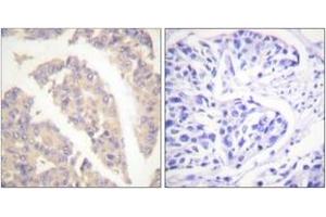 Immunohistochemistry (IHC) image for anti-Cas-Br-M (Murine) Ecotropic Retroviral Transforming Sequence (CBL) (AA 666-715) antibody (ABIN2888651) (CBL Antikörper  (AA 666-715))