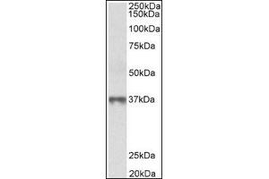 MAT2B  Antibody staining of Human Thymus lysate at 0. (MAT2B Antikörper  (Isoform 1, N-Term))