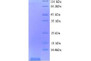 SDS-PAGE (SDS) image for Shiga Toxin Subunit B (STXB) (AA 21-89) protein (His tag) (ABIN5713960)