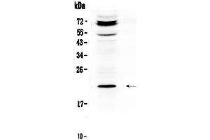Western blot analysis of C19orf80 using anti-C19orf80 antibody . (C19ORF80 Antikörper  (AA 22-198))