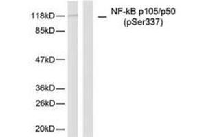 Western blot analysis of extracts from MDA-MB-435 cells, using NF-kappaB p105/p50 (Phospho-Ser337) Antibody. (NFKB1 Antikörper  (pSer337))