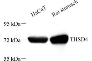 Western blot analysis of THSD4 (ABIN7075894),at dilution of 1: 2000 (Thrombospondin, Type I, Domain Containing 4 (THSD4) Antikörper)