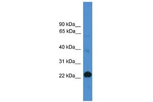 WB Suggested Anti-CD8A Antibody Titration: 0. (CD8 alpha Antikörper  (Middle Region))