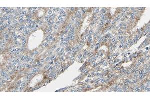 ABIN6268945 at 1/100 staining Human prostate tissue by IHC-P. (MARCKS Antikörper  (Internal Region))