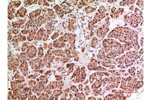 Immunohistochemistry (IHC) analysis of paraffin-embedded Human Pancreas, antibody was diluted at 1:100. (HPSE Antikörper  (Internal Region))