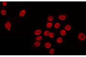 ABIN6274702 staining HeLa by IF/ICC. (RAD54L Antikörper  (C-Term))