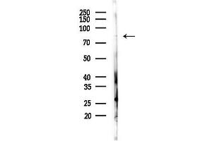 anti-GC-Rich Sequence DNA-Binding Factor 2 (GCFC2) antibody