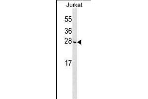 CGGBP1 Antibody (C-term) (ABIN1536689 and ABIN2849923) western blot analysis in Jurkat cell line lysates (35 μg/lane). (CGGBP1 Antikörper  (C-Term))