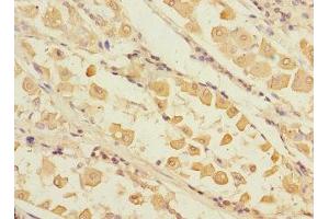 Immunohistochemistry (IHC) image for anti-Ring Finger and CHY Zinc Finger Domain Containing 1, E3 Ubiquitin Protein Ligase (RCHY1) (AA 1-261) antibody (ABIN7168232)