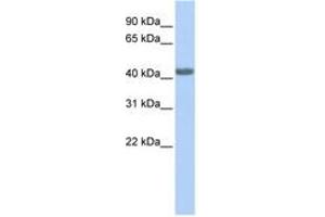 Image no. 1 for anti-Chemokine (C-C Motif) Receptor 2 (CCR2) (AA 216-265) antibody (ABIN6744270) (CCR2 Antikörper  (AA 216-265))