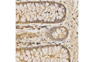 Immunohistochemistry of paraffin-embedded human colon using GLB1 antibody at dilution of 1:200 (x400 lens)