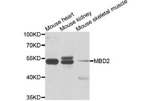 Western blot analysis of extracts of various cell lines, using MBD2 antibody. (MBD2 Antikörper)