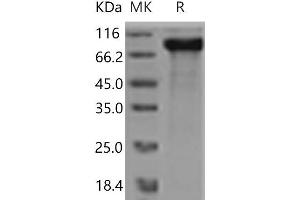 Western Blotting (WB) image for V-Erb-A erythroblastic Leukemia Viral Oncogene Homolog 4 (Avian) (ERBB4) (Active) protein (His tag) (ABIN7321212)