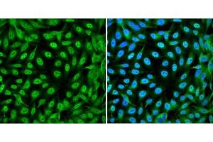 Immunofluorescence analysis of DLD-1 cells showing nuclear and cytoplasmic localization with YAP1 antibody 1:200 (left,green). (YAP1 Antikörper)