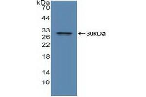 Western blot analysis of recombinant Human IDE. (IDE Antikörper  (AA 753-973))