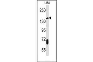 Western blot analysis of JHDM2a Antibody (C-term) in UM cell line lysates (35ug/lane). (KDM3A Antikörper  (C-Term))