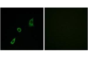 Immunofluorescence analysis of HuvEc cells, using FGF23 Antibody. (FGF23 Antikörper  (AA 151-200))