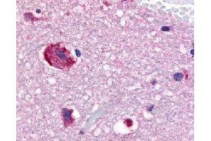 Immunohistochemical (Formalin/PFA-fixed paraffin-embedded sections) staining in human brain (caudate) with GPR61 polyclonal antibody . (GPR61 Antikörper)