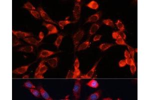 Immunofluorescence analysis of NIH-3T3 cells using MRPS28 Polyclonal Antibody at dilution of 1:100 (40x lens). (MRPS28 Antikörper)