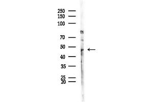 Western blot analysis of lysates from HepG2 cells(LPS,4h treatment), using SERPIN Antibody at 1/1000 dilution.