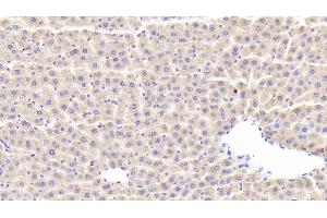 Immunohistochemistry (IHC) image for anti-Chemokine (C-C Motif) Ligand 21 (CCL21) (AA 5-132) antibody (ABIN7438628)