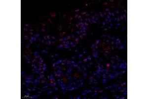 Immunofluorescence of paraffin embedded mouse skin using notch3 (ABIN7074862) at dilution of 1:650 (400x lens) (NOTCH3 Antikörper)