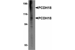 Image no. 1 for anti-Protocadherin 12 (PCDH12) (N-Term) antibody (ABIN478055) (PCDH12 Antikörper  (N-Term))