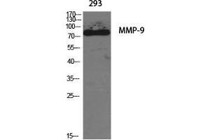 Western Blot (WB) analysis of specific cells using MMP-9 Polyclonal Antibody. (MMP 9 Antikörper  (C-Term))