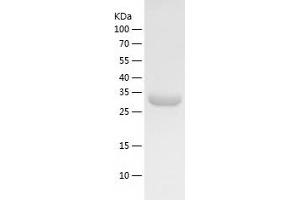 Western Blotting (WB) image for Annexin A13 (ANXA13) (AA 1-316) protein (His tag) (ABIN7121845)