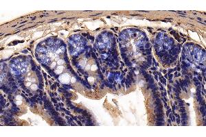 Detection of FUR in Mouse Colon Tissue using Polyclonal Antibody to Furin (FUR) (FURIN Antikörper  (AA 418-573))