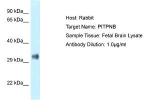 Host: Rabbit Target Name: PITPNB Sample Type: Fetal Brain lysates Antibody Dilution: 1.